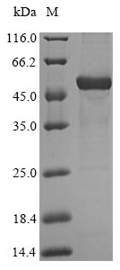 HAO2 Protein - (Tris-Glycine gel) Discontinuous SDS-PAGE (reduced) with 5% enrichment gel and 15% separation gel.