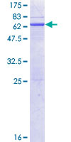 HAO2 Protein - 12.5% SDS-PAGE of human HAO2 stained with Coomassie Blue