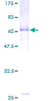HAPLN1 Protein - 12.5% SDS-PAGE of human HAPLN1 stained with Coomassie Blue