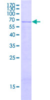 HAPLN2 Protein - 12.5% SDS-PAGE of human HAPLN2 stained with Coomassie Blue