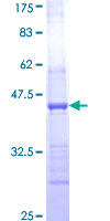 HAPLN2 Protein - 12.5% SDS-PAGE Stained with Coomassie Blue.