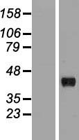 HAPLN3 Protein - Western validation with an anti-DDK antibody * L: Control HEK293 lysate R: Over-expression lysate