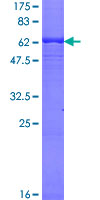 HAPLN3 Protein - 12.5% SDS-PAGE of human HAPLN3 stained with Coomassie Blue