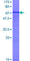 HAPLN3 Protein - 12.5% SDS-PAGE of human HAPLN3 stained with Coomassie Blue