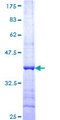 HAPLN4 Protein - 12.5% SDS-PAGE Stained with Coomassie Blue.