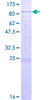 Harmonin / USH1C Protein - 12.5% SDS-PAGE of human USH1C stained with Coomassie Blue