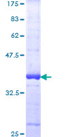 Harmonin / USH1C Protein - 12.5% SDS-PAGE Stained with Coomassie Blue.