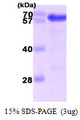 Harmonin / USH1C Protein