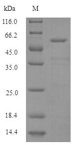 HARS Protein - (Tris-Glycine gel) Discontinuous SDS-PAGE (reduced) with 5% enrichment gel and 15% separation gel.