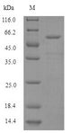 HARS Protein - (Tris-Glycine gel) Discontinuous SDS-PAGE (reduced) with 5% enrichment gel and 15% separation gel.