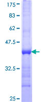 HARS Protein - 12.5% SDS-PAGE Stained with Coomassie Blue.