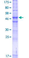 HARV1 / ARV1 Protein - 12.5% SDS-PAGE of human ARV1 stained with Coomassie Blue