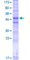 HARV1 / ARV1 Protein - 12.5% SDS-PAGE of human ARV1 stained with Coomassie Blue