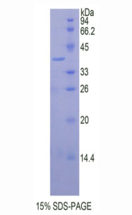 HAS1 / HAS Protein - Recombinant Hyaluronan Synthase 1 (HAS1) by SDS-PAGE