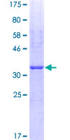 HAS2 Protein - 12.5% SDS-PAGE Stained with Coomassie Blue.