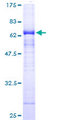 HAT1 Protein - 12.5% SDS-PAGE of human HAT1 stained with Coomassie Blue