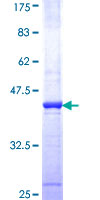 HAT1 Protein - 12.5% SDS-PAGE Stained with Coomassie Blue.
