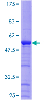 HAUS1 / CCDC5 Protein - 12.5% SDS-PAGE of human CCDC5 stained with Coomassie Blue