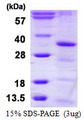 HAUS1 / CCDC5 Protein