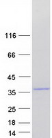 HAUS1 / CCDC5 Protein - Purified recombinant protein HAUS1 was analyzed by SDS-PAGE gel and Coomassie Blue Staining