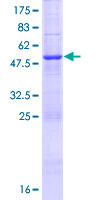 HAUS2 Protein - 12.5% SDS-PAGE of human CEP27 stained with Coomassie Blue