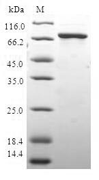 HAUS4 Protein - (Tris-Glycine gel) Discontinuous SDS-PAGE (reduced) with 5% enrichment gel and 15% separation gel.
