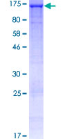 HAUS6 / FAM29A Protein - 12.5% SDS-PAGE of human FAM29A stained with Coomassie Blue