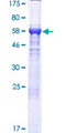 HAUS7 Protein - 12.5% SDS-PAGE of human UCHL5IP stained with Coomassie Blue
