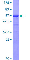 HAUS8 Protein - 12.5% SDS-PAGE of human NY-SAR-48 stained with Coomassie Blue