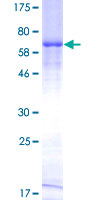 HAVCR1 / KIM-1 Protein - 12.5% SDS-PAGE of human HAVCR1 stained with Coomassie Blue