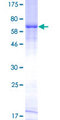 HAVCR1 / KIM-1 Protein - 12.5% SDS-PAGE of human HAVCR1 stained with Coomassie Blue
