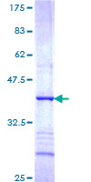 HAVCR1 / KIM-1 Protein - 12.5% SDS-PAGE Stained with Coomassie Blue.