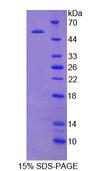 HAVCR1 / KIM-1 Protein - Recombinant Kidney Injury Molecule 1 By SDS-PAGE