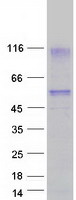 HAVCR1 / KIM-1 Protein - Purified recombinant protein HAVCR1 was analyzed by SDS-PAGE gel and Coomassie Blue Staining