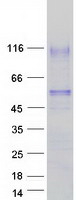 HAVCR1 / KIM-1 Protein - Purified recombinant protein HAVCR1 was analyzed by SDS-PAGE gel and Coomassie Blue Staining