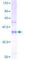 HAVCR2 / TIM-3 Protein - 12.5% SDS-PAGE of human HAVCR2 stained with Coomassie Blue