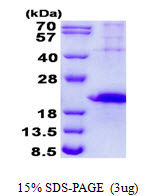 HAVCR2 / TIM-3 Protein