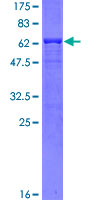 HAX-1 Protein - 12.5% SDS-PAGE of human HAX1 stained with Coomassie Blue