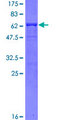 HAX-1 Protein - 12.5% SDS-PAGE of human HAX1 stained with Coomassie Blue