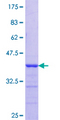 HAX-1 Protein - 12.5% SDS-PAGE Stained with Coomassie Blue.