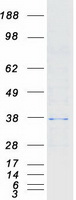 HAX-1 Protein - Purified recombinant protein HAX1 was analyzed by SDS-PAGE gel and Coomassie Blue Staining