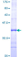 HBA1 Protein - 12.5% SDS-PAGE Stained with Coomassie Blue.