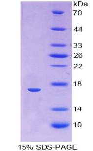 HBA1 Protein - Recombinant Hemoglobin Alpha 1 By SDS-PAGE
