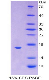 HBA1 Protein - Recombinant Hemoglobin Alpha 1 By SDS-PAGE