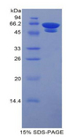 HbA1c / Hemoglobin a1c Protein - Native Glycated Hemoglobin A1c By SDS-PAGE