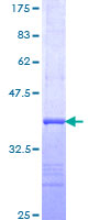HBB / Hemoglobin Beta Protein - 12.5% SDS-PAGE Stained with Coomassie Blue.