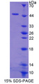 HBD / Hemoglobin Delta Protein - Recombinant  Hemoglobin Delta By SDS-PAGE