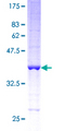 HBE1 / Hemoglobin Epsilon 1 Protein - 12.5% SDS-PAGE of human HBE1 stained with Coomassie Blue