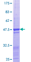 HBEGF / HB EGF Protein - 12.5% SDS-PAGE of human HBEGF stained with Coomassie Blue