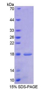 HBEGF / HB EGF Protein - Recombinant Heparin Binding Epidermal Growth Factor Like Growth Factor By SDS-PAGE